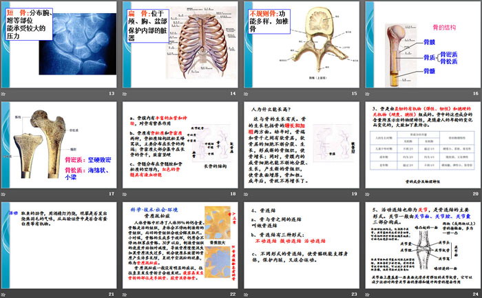 《人的运动系统和保健》PPT